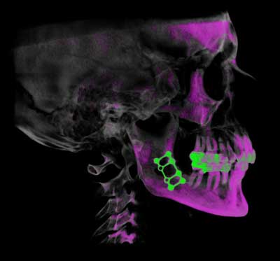 dvt-kfo-11.jpg